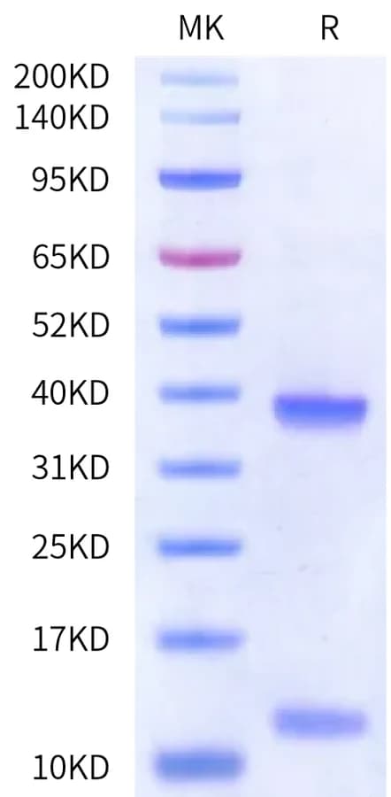 Bis-Tris PAGE Data