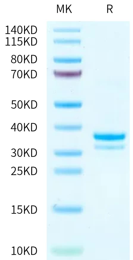 Bis-Tris PAGE Data