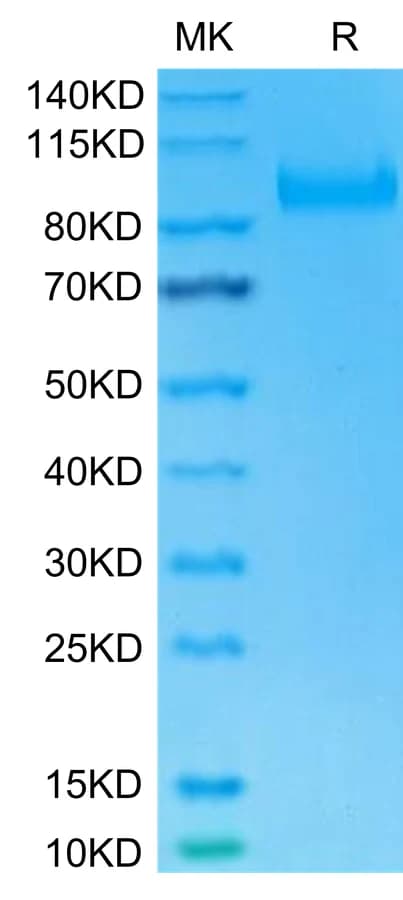 Bis-Tris PAGE Data