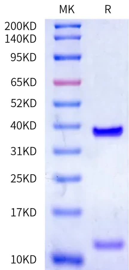 Bis-Tris PAGE Data