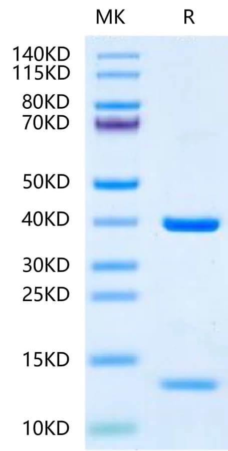 Bis-Tris PAGE Data