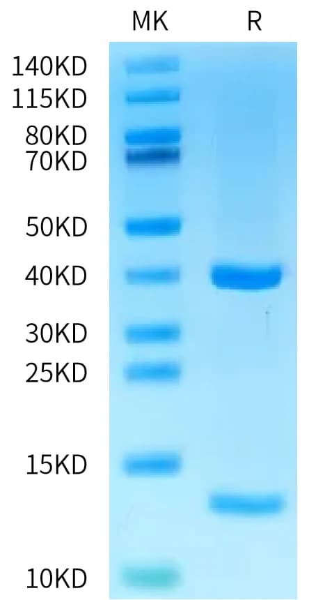 Bis-Tris PAGE Data