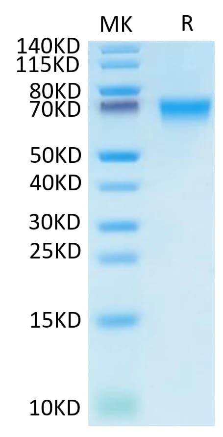 Bis-Tris PAGE Data