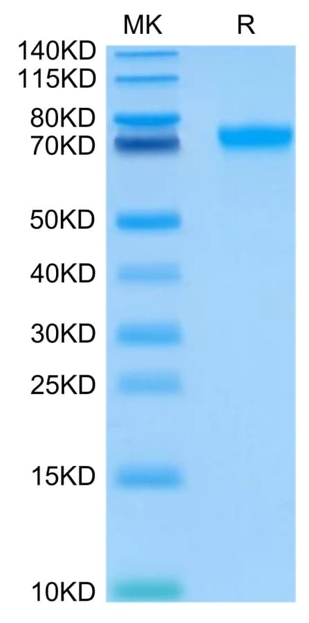 Bis-Tris PAGE Data