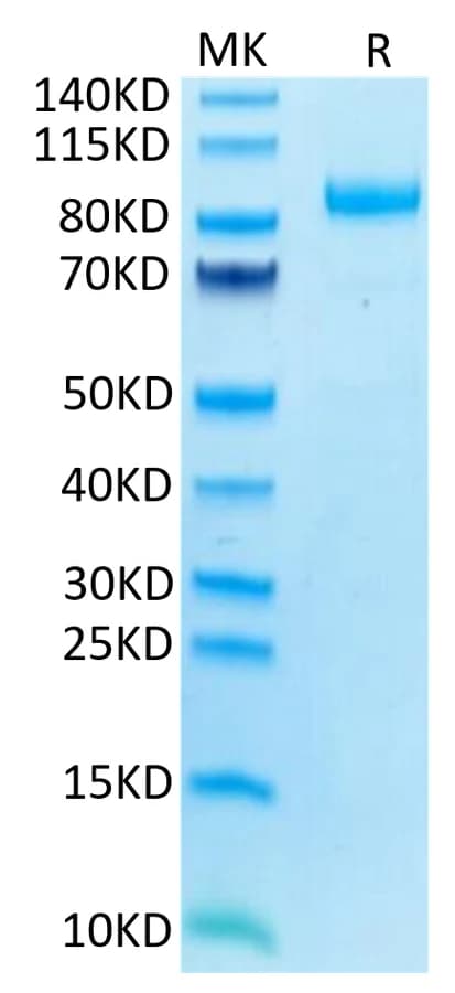 Bis-Tris PAGE Data
