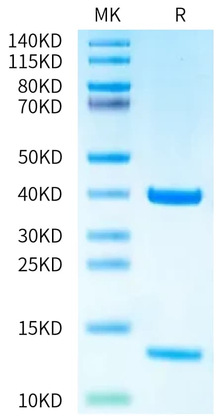 Bis-Tris PAGE Data