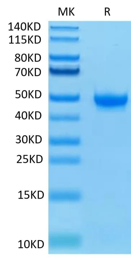 Bis-Tris PAGE Data