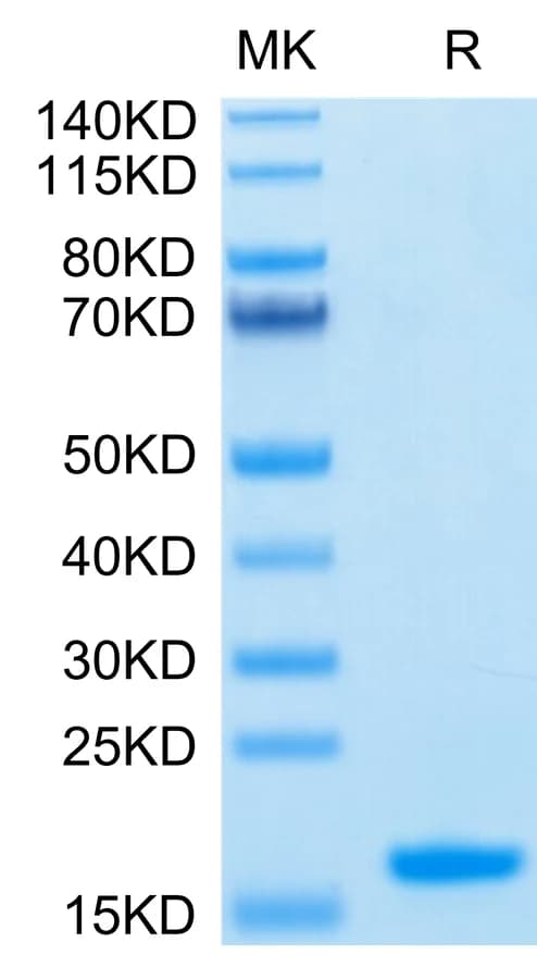 Bis-Tris PAGE Data
