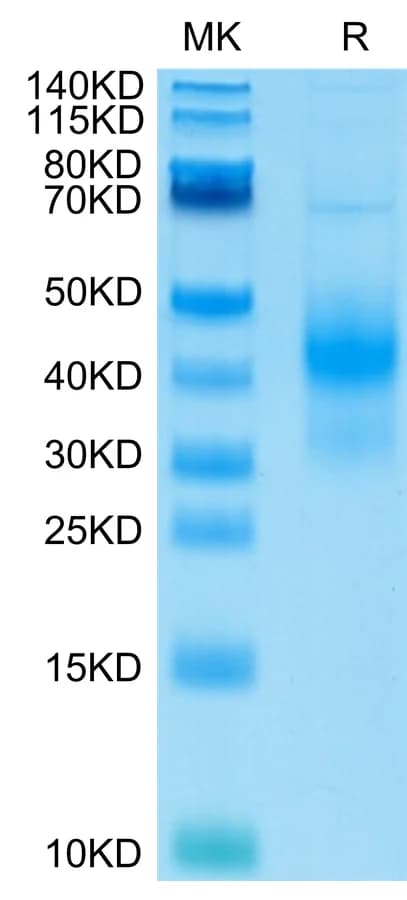 Bis-Tris PAGE Data