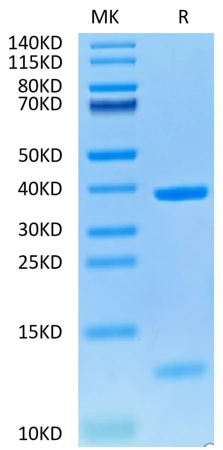 Bis-Tris PAGE Data