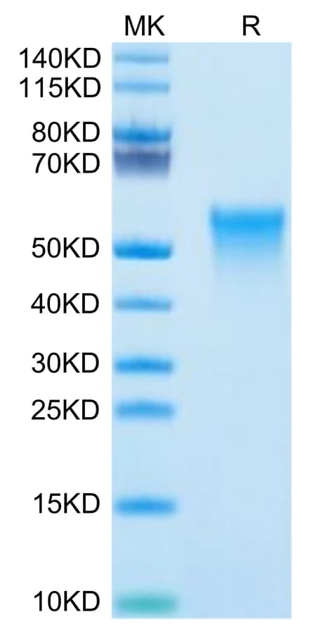 Bis-Tris PAGE Data