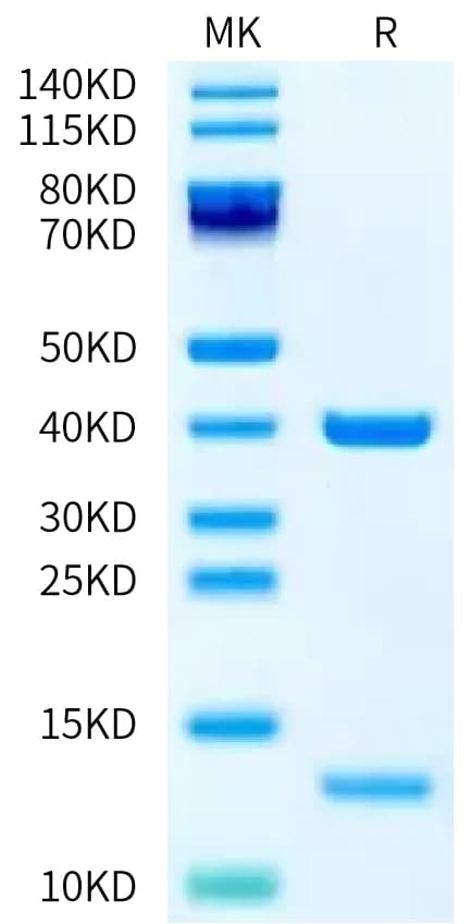 Bis-Tris PAGE Data