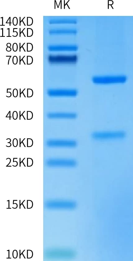 Bis-Tris PAGE Data