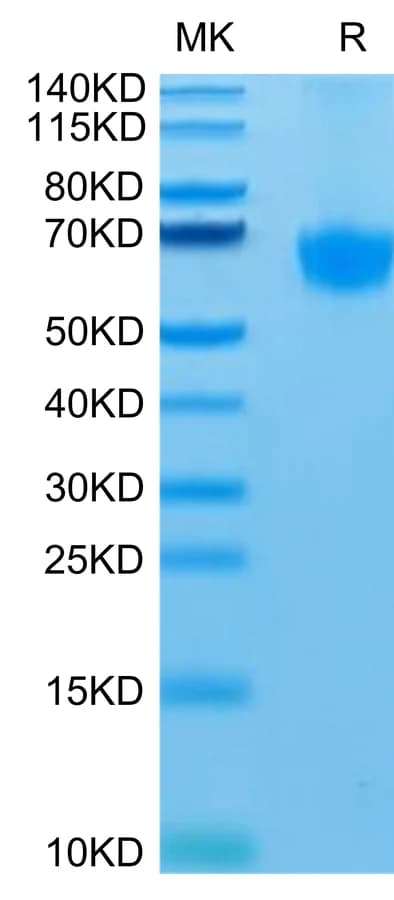Bis-Tris PAGE Data