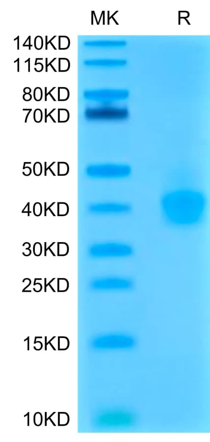 Bis-Tris PAGE Data