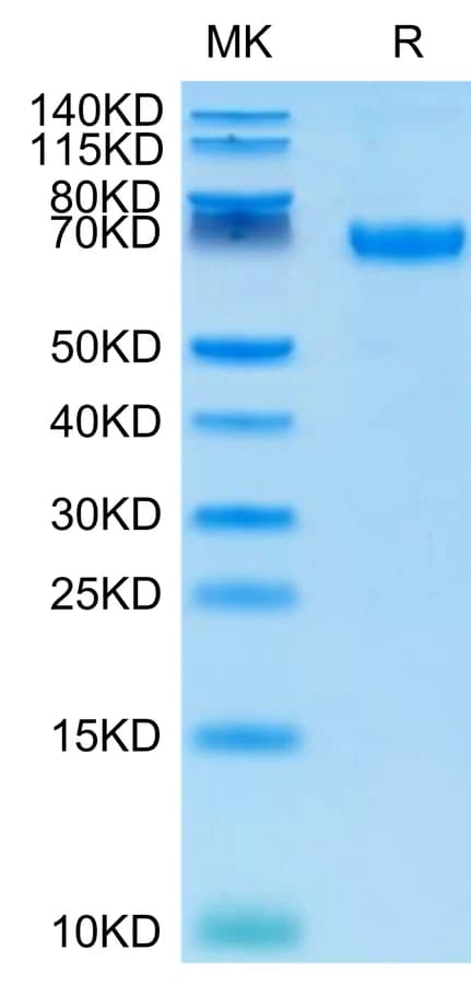 Bis-Tris PAGE Data