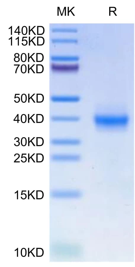 Bis-Tris PAGE Data