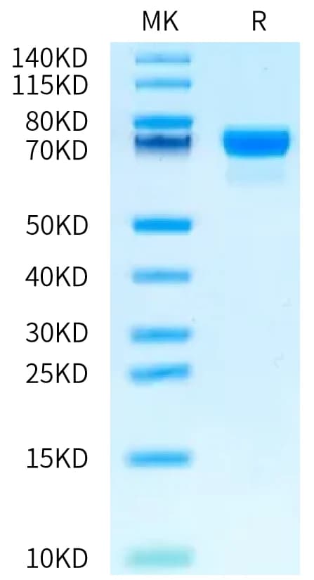 Bis-Tris PAGE Data