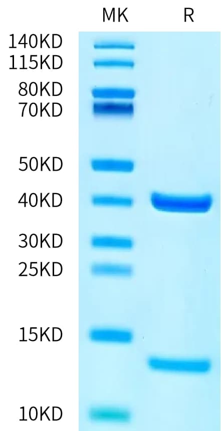 Bis-Tris PAGE Data