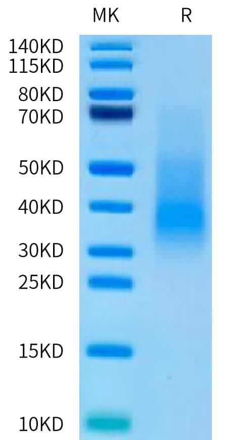 Bis-Tris PAGE Data