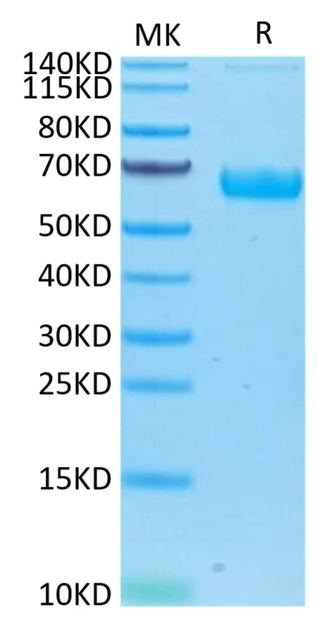 Bis-Tris PAGE Data