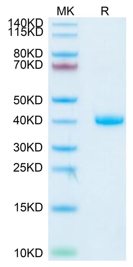Bis-Tris PAGE Data
