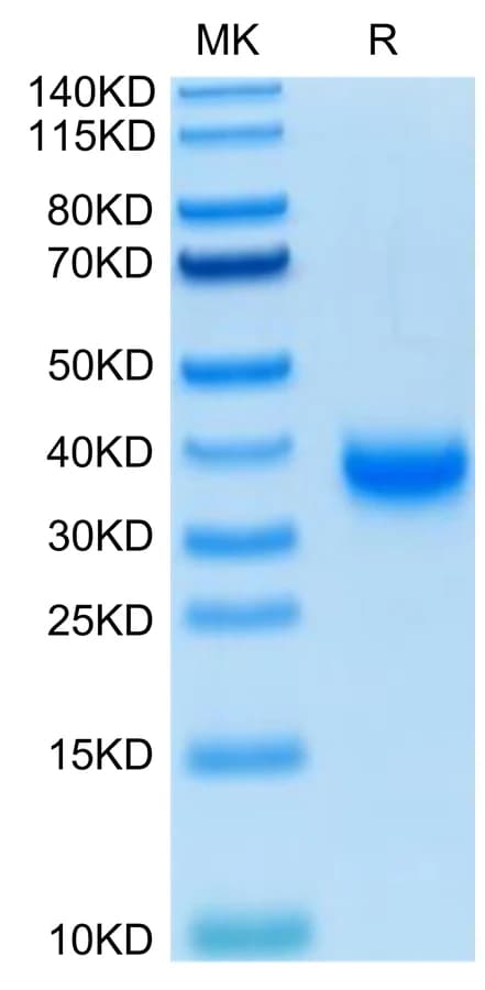 Bis-Tris PAGE Data