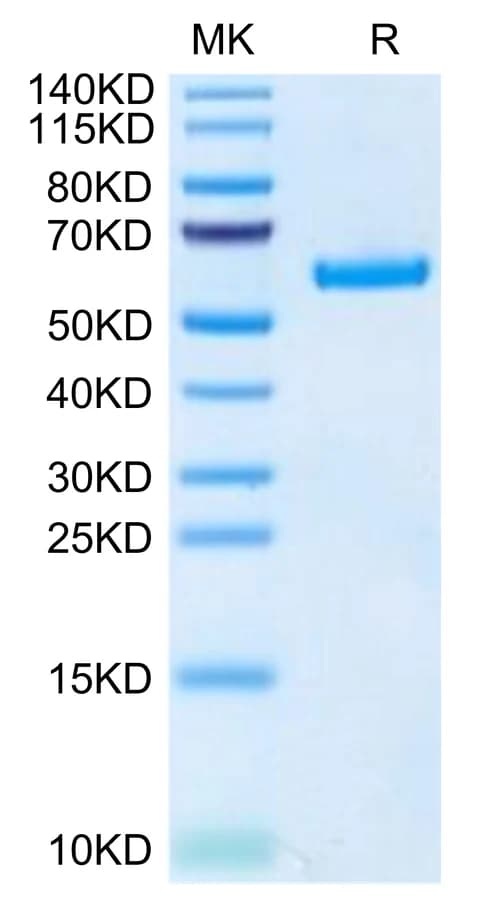 Bis-Tris PAGE Data
