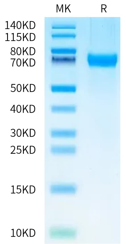 Bis-Tris PAGE Data
