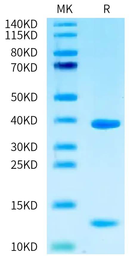 Bis-Tris PAGE Data