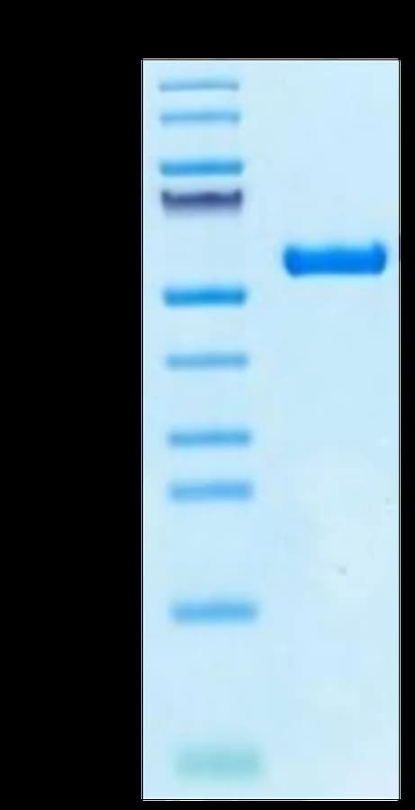 Bis-Tris PAGE Data