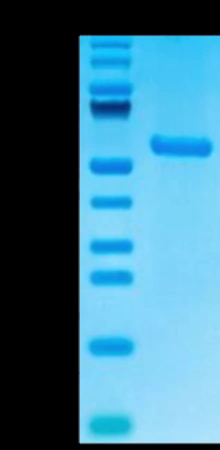 Bis-Tris PAGE Data
