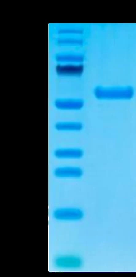 Bis-Tris PAGE Data