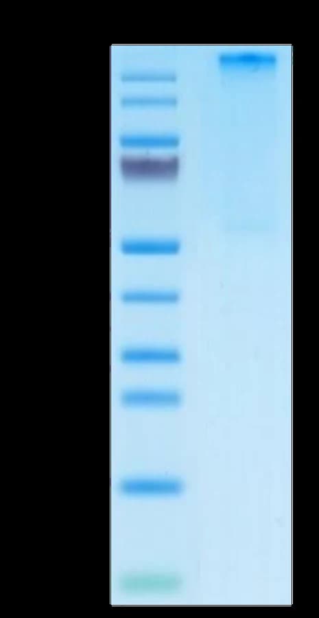 Bis-Tris PAGE Data