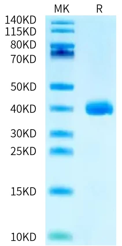 Bis-Tris PAGE Data