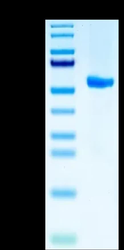 Bis-Tris PAGE Data