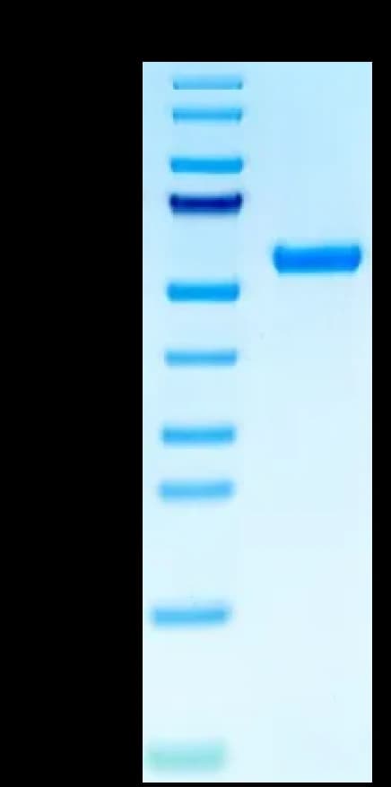 Bis-Tris PAGE Data