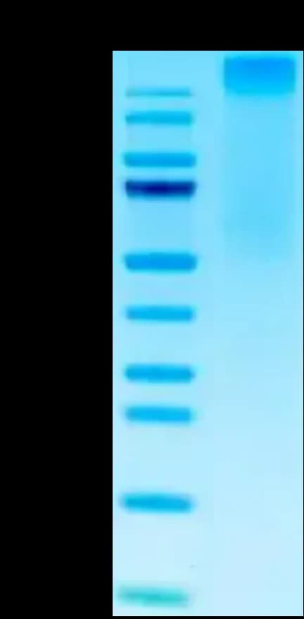 Bis-Tris PAGE Data