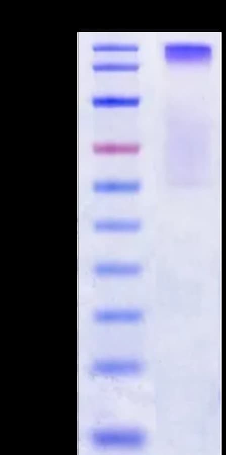 Bis-Tris PAGE Data
