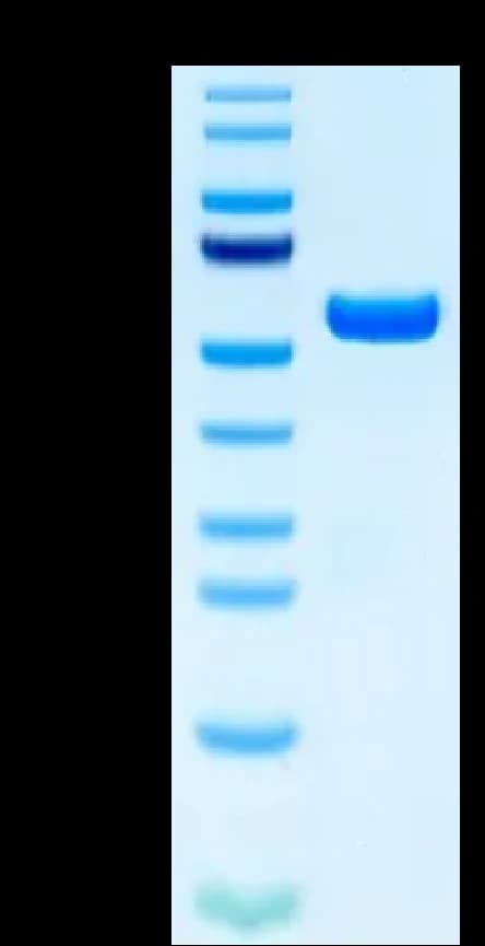 Bis-Tris PAGE Data