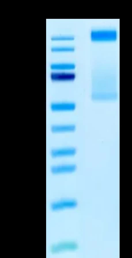 Bis-Tris PAGE Data