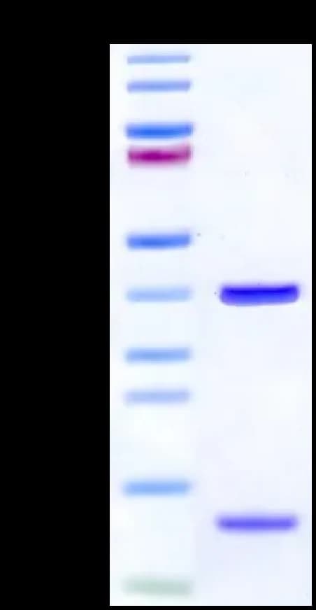 Bis-Tris PAGE Data