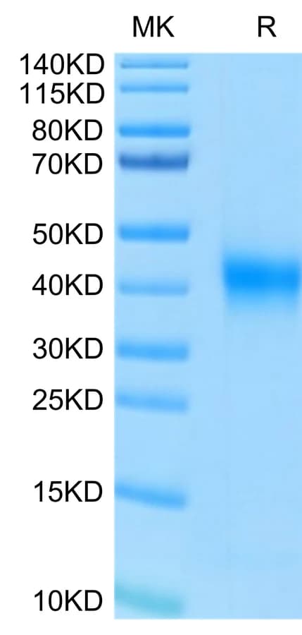 Bis-Tris PAGE Data