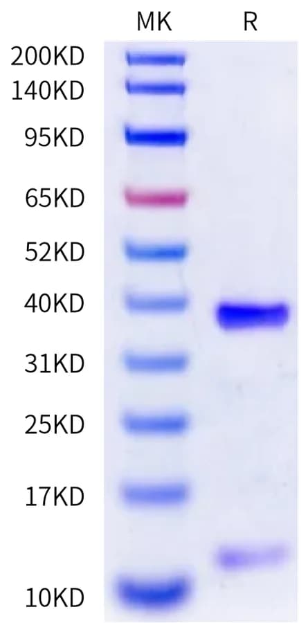 Bis-Tris PAGE Data