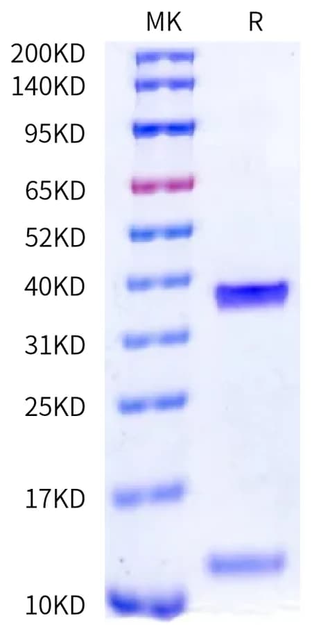 Bis-Tris PAGE Data