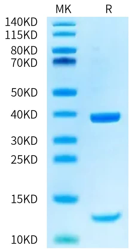 Bis-Tris PAGE Data