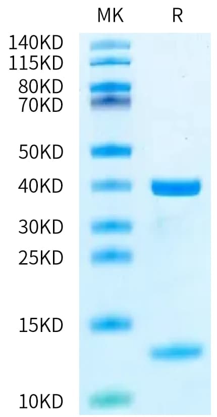 Bis-Tris PAGE Data