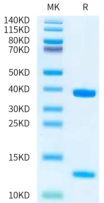 Bis-Tris PAGE Data