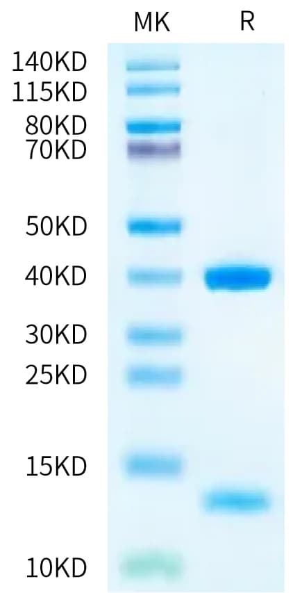 Bis-Tris PAGE Data
