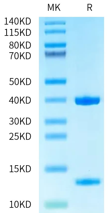 Bis-Tris PAGE Data